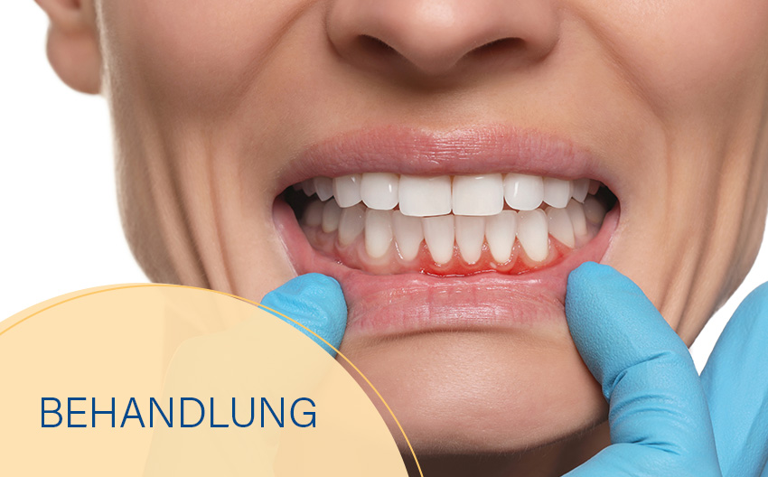 Modul: Parodontologie