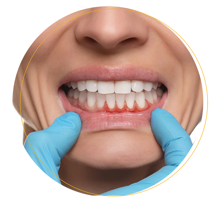linudent-parodonthologie-header