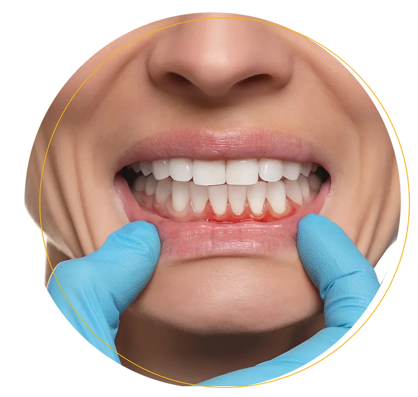 linudent-parodonthologie-header